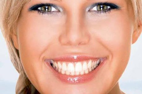 SGK Estetik Diş Tedavilerini Karşılıyor
