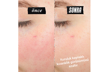 Yeni Ultra Facial Meltdown Onar�c� Y�z Kremi ile Cildin Alarm Verdi�inde Kontrol Sende!
