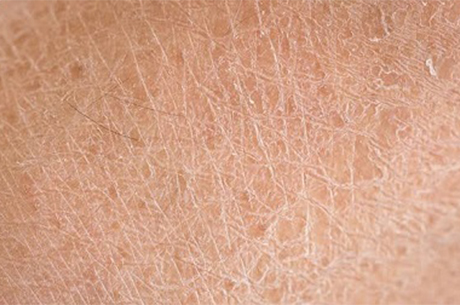 K���n Cilt Kurulu�una Kar�� 6 Etkili �nlem!